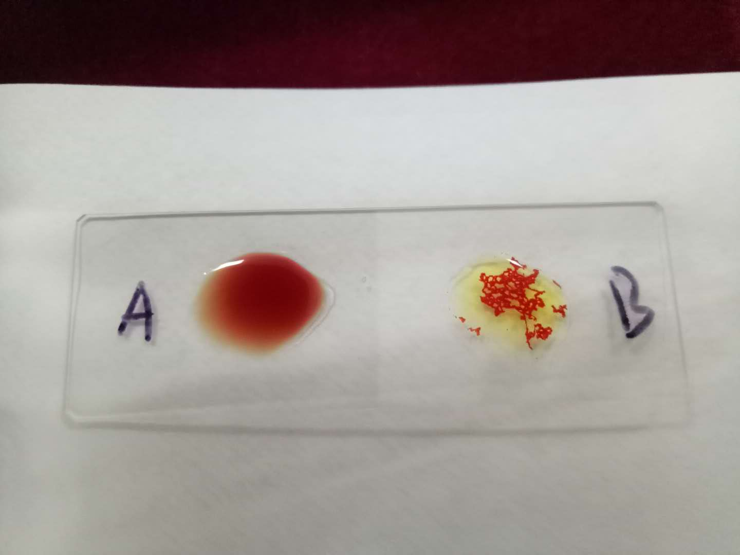 醫(yī)學(xué)檢驗(yàn)專業(yè)志愿者活動(dòng)